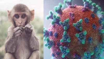 شیوع آبله میمون با علائمی متفاوت