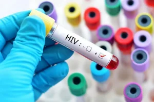 درمان «ایدز» رایگان است/ ویروس HIV قابل کنترل است به شرط درمان