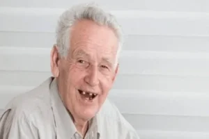 بیش از نیمی از افراد بالای ۶۵ سال در کشور هیچ دندانی ندارند