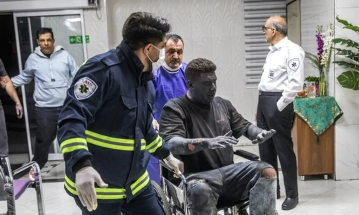 میزان سوختگی در ایران ۸ برابر میانگین جهانی