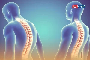 کنترل دردهای مزمن و شدید با پمپ داخل نخاعی