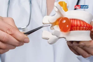 دیسک کمر همیشه به جراحی ختم نمی‌شود